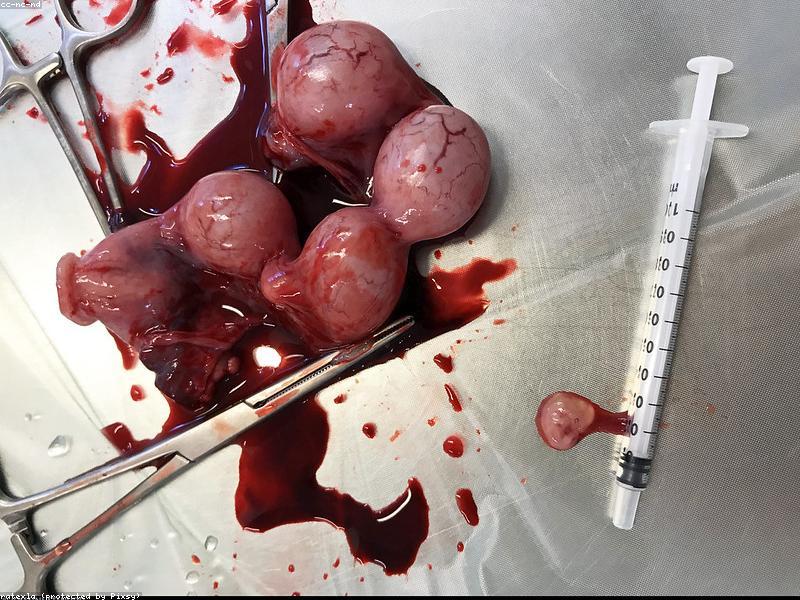 Blog Post illustration